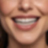 Smiling woman after dental veneers